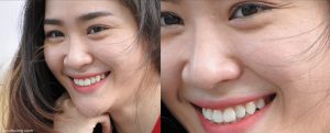 tăng kích thước ảnh trong Photoshop siêu nét