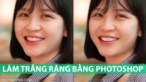 Cách làm trắng răng bằng Photoshop